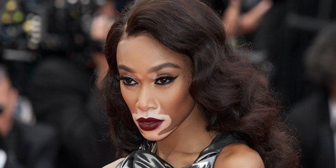 Winnie Harlow - Age, Family, Bio | Famous Birthdays